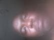 John Doe